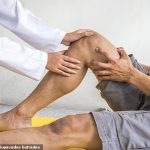 Wadliwe wymiany stawu kolanowego wykonano u 10 000 pacjentów